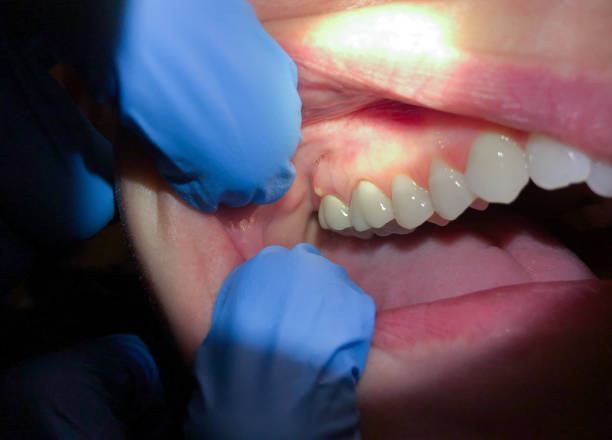 Best Cosmetic Emergency Dentistry in Barrington, NJ