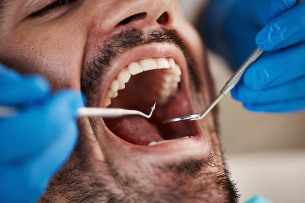 Best Weekend Emergency Dentist in Barrington, NJ